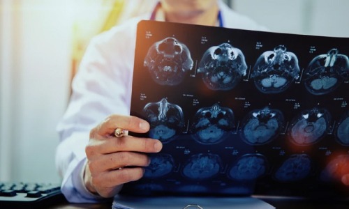 Mobile health treatments in Denver. Drug-free concussion treatments in Denver.